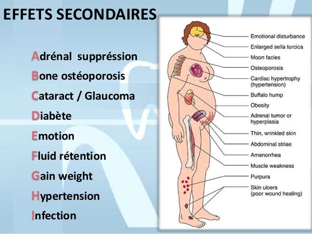 effet secondaire des anti inflammatoire effet secondaire des anti inflammatoire